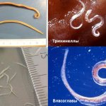 Roundworms (nematodes)